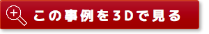 この事例を3Dで見る
